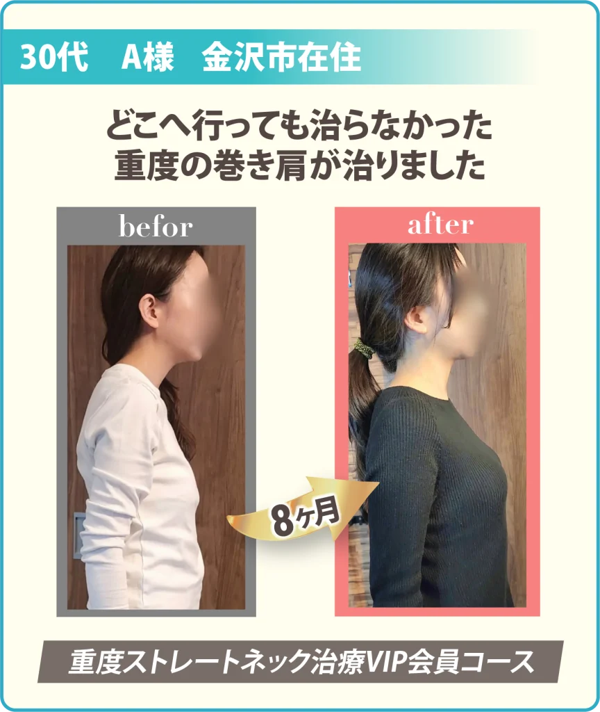 患者様の姿勢の変化写真