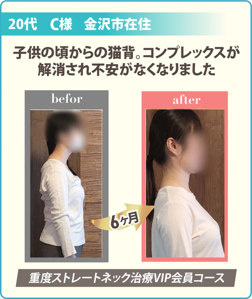 患者様の姿勢の変化写真