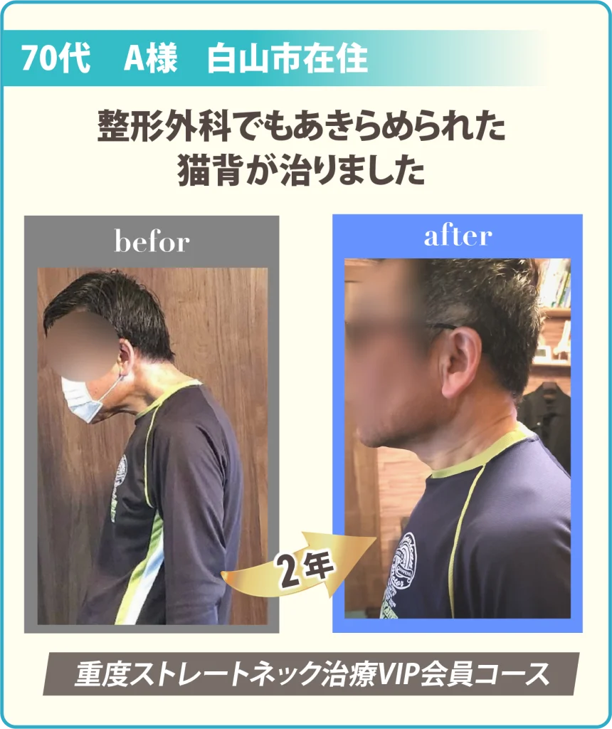 患者様の姿勢の変化写真
