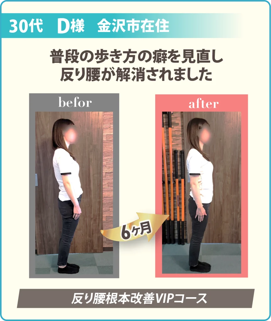 患者様の姿勢の変化写真