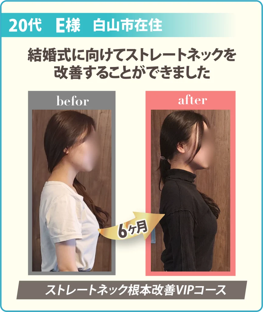 患者様の姿勢の変化写真